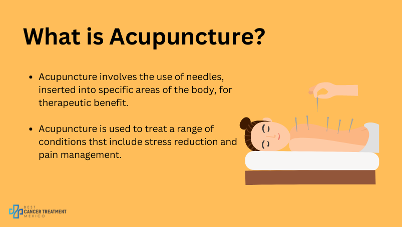 What is acupuncture?