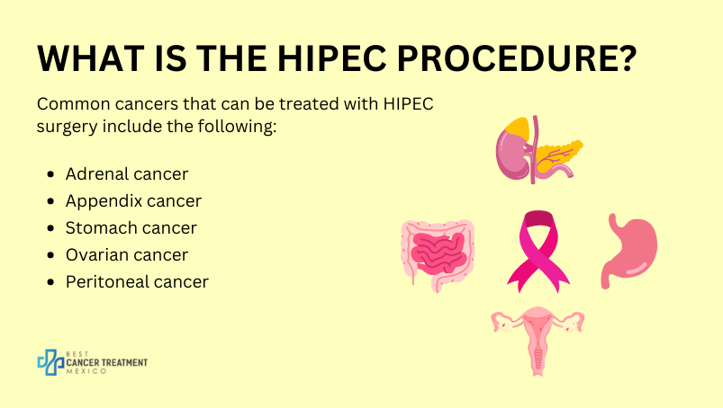 What is the HIPEC procedure?